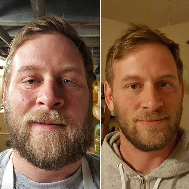 wygląd osoby przed i po odstawieniu alkoholu